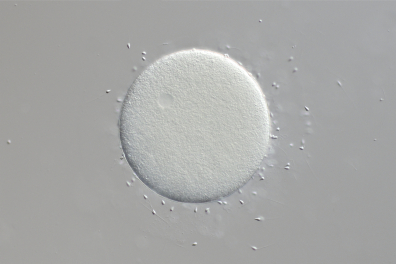 Fécondation chez l'Oursin (Sphaerechinus granularis) x100